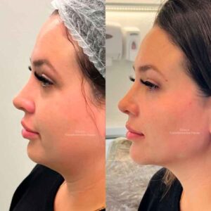 antes-e-depois-12-1d18a27a